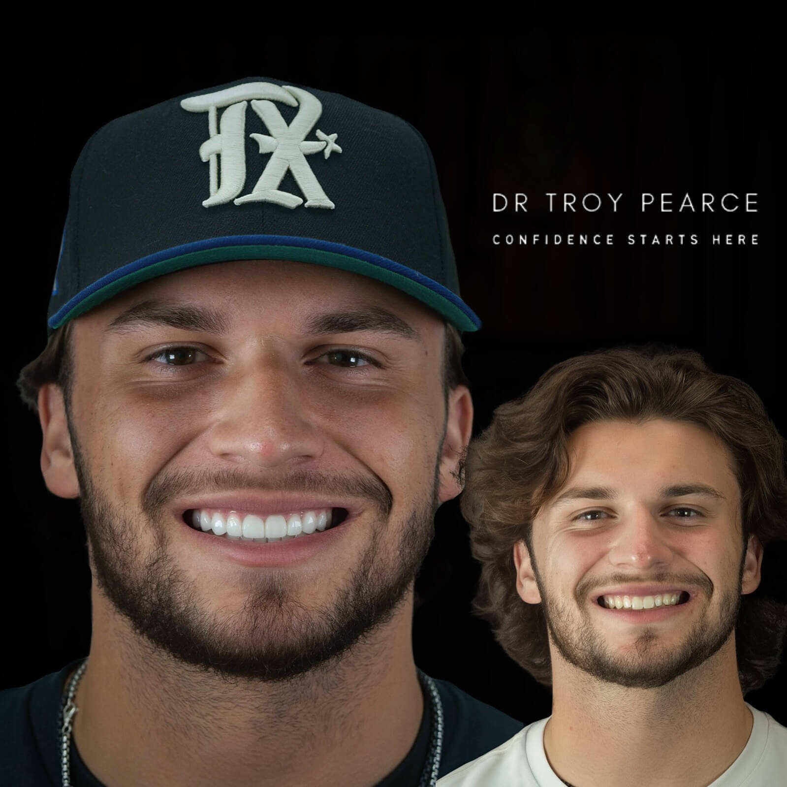 patient after before