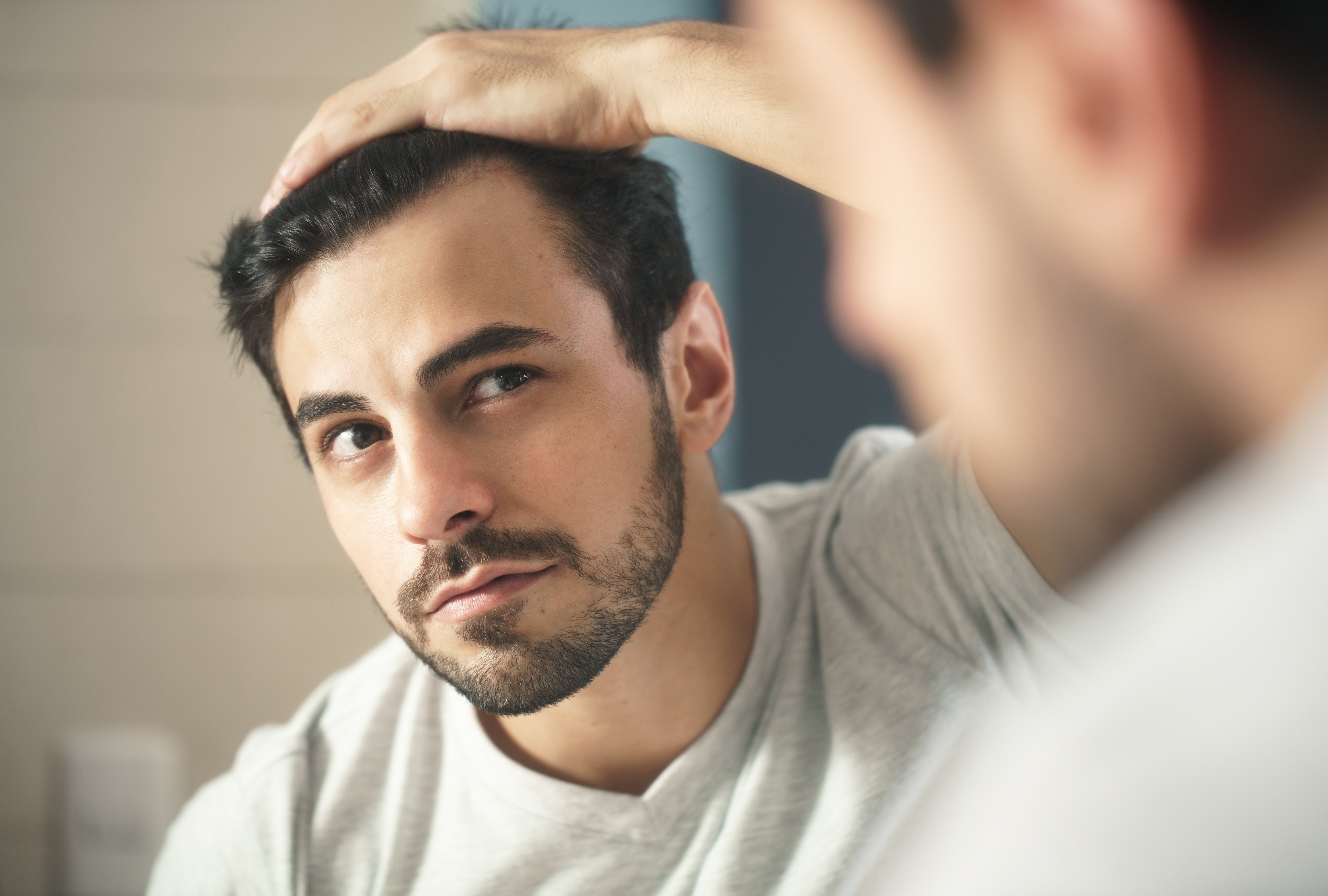 Hair + Me - male pattern hair loss androgenetic alopecia, male baldness
