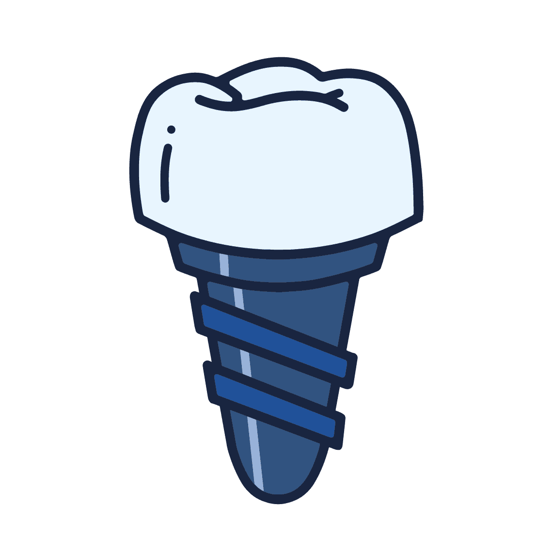 Illustration of a dental implant