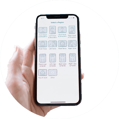 SkinIO results portal showing skin cancer screening analysis.