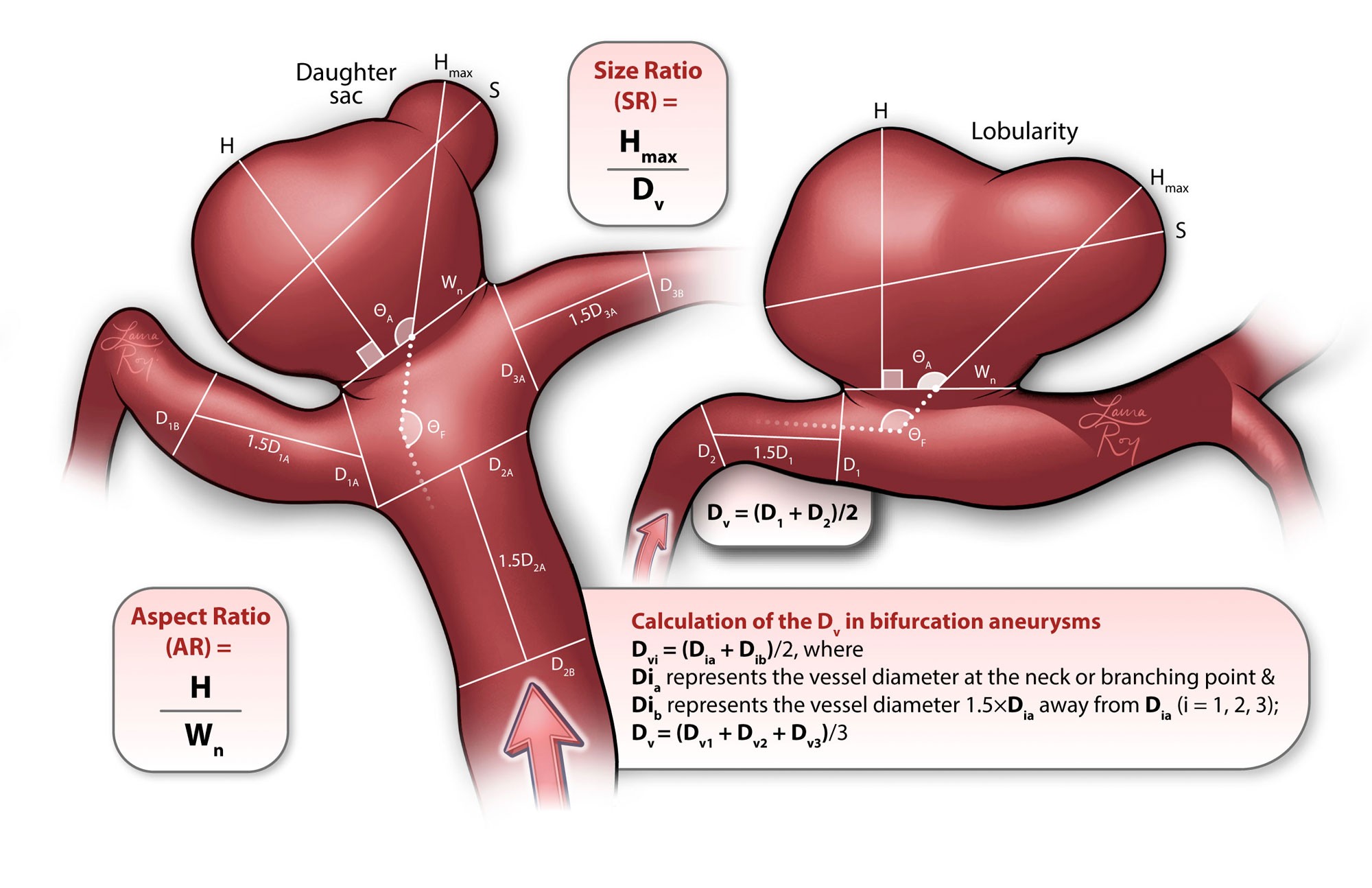 Aneurysm Measurement