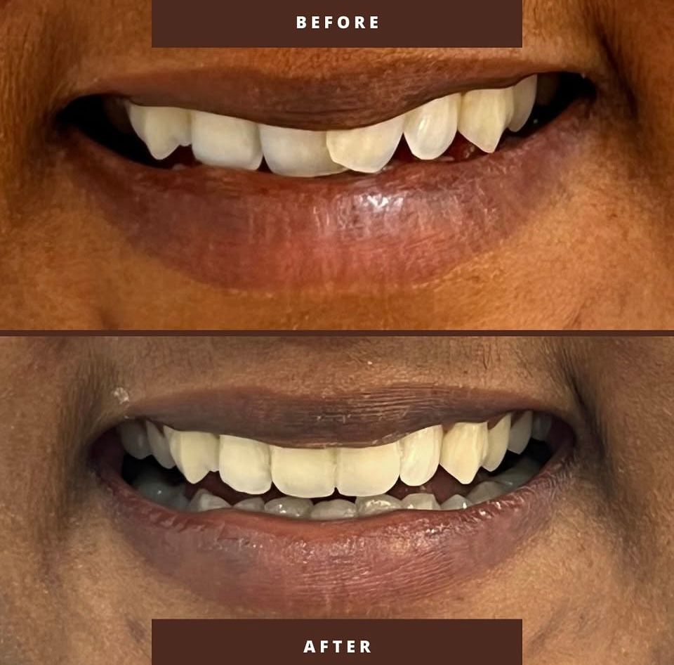 man in black and white nike zip up jacket smiling