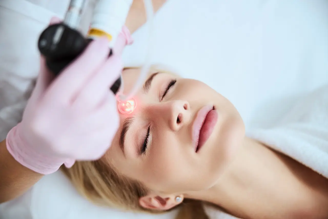 Fractional CO2 laser at Biogenica
