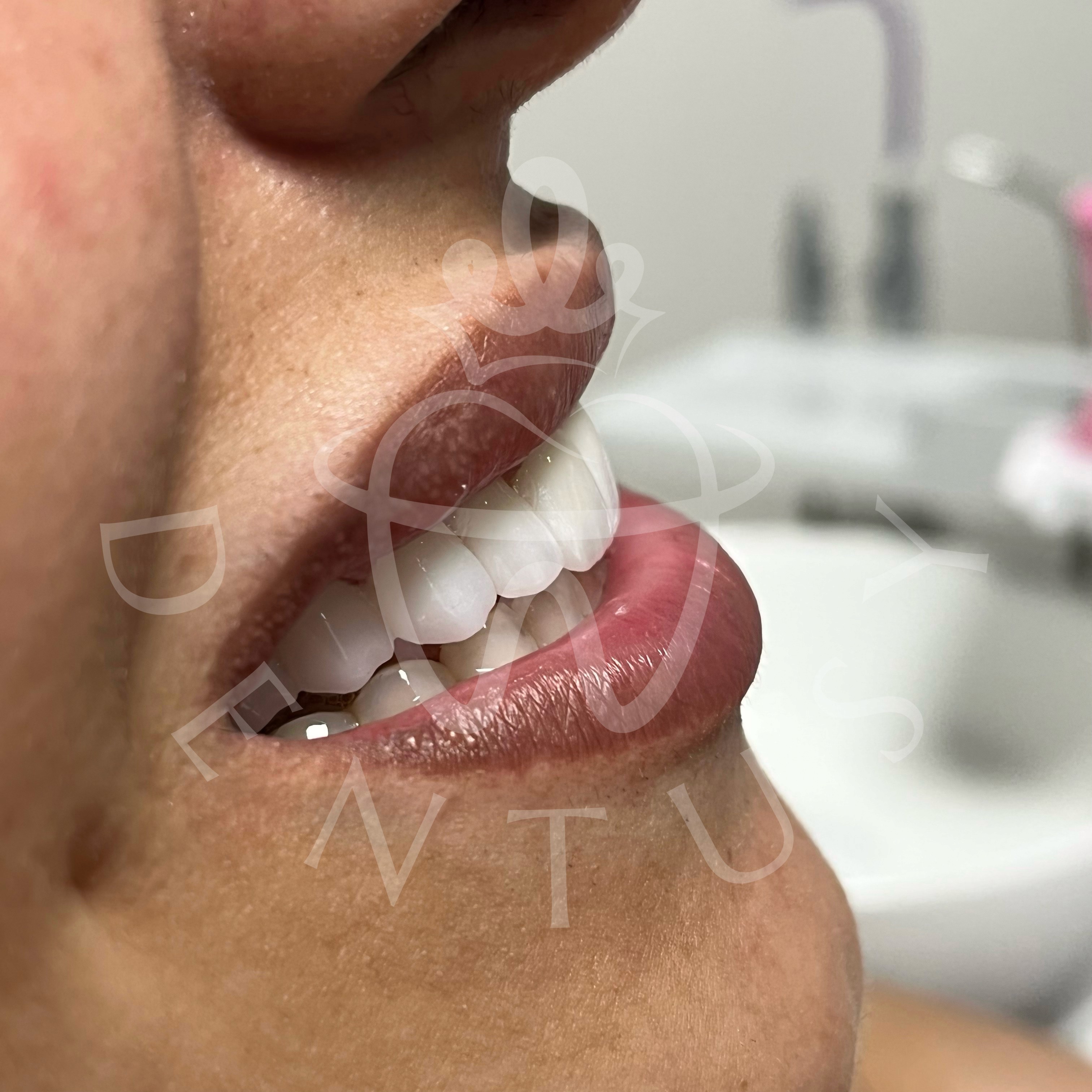 Here comes the alt text