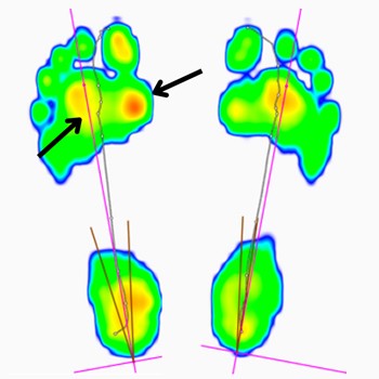 Empreintes de pieds