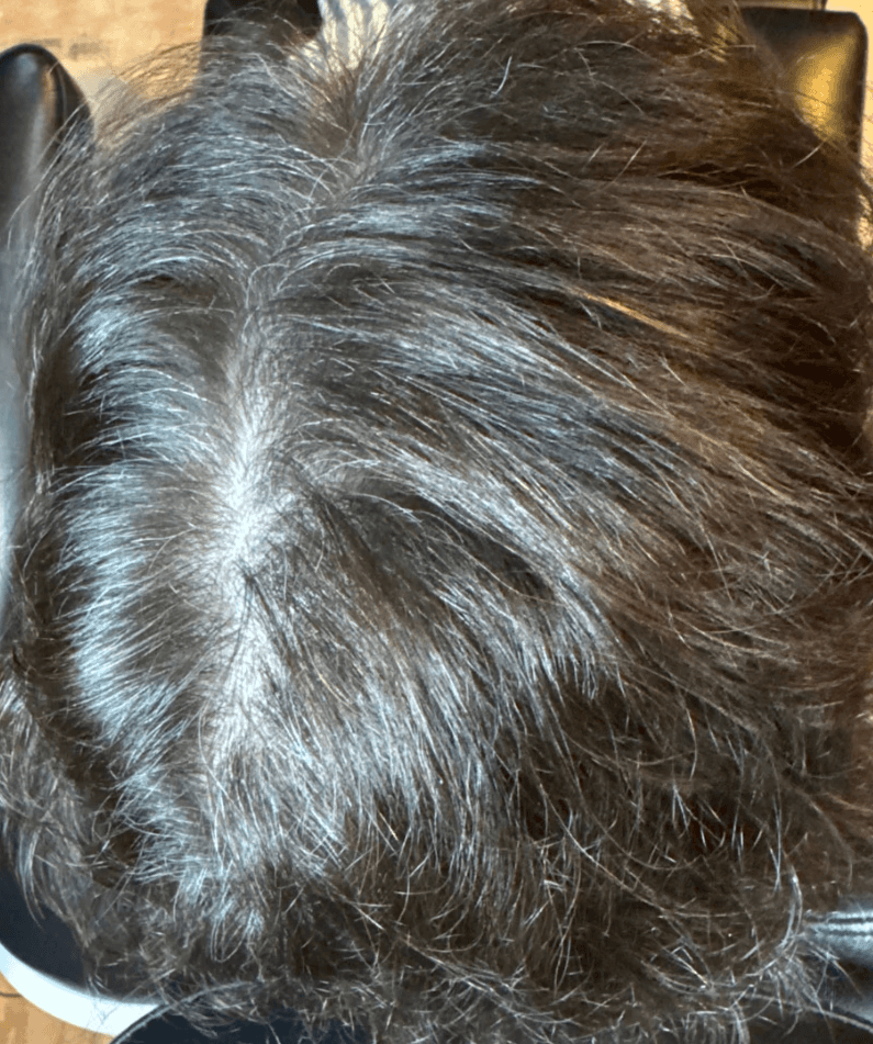 Successful FoLix client in March 2026 after
