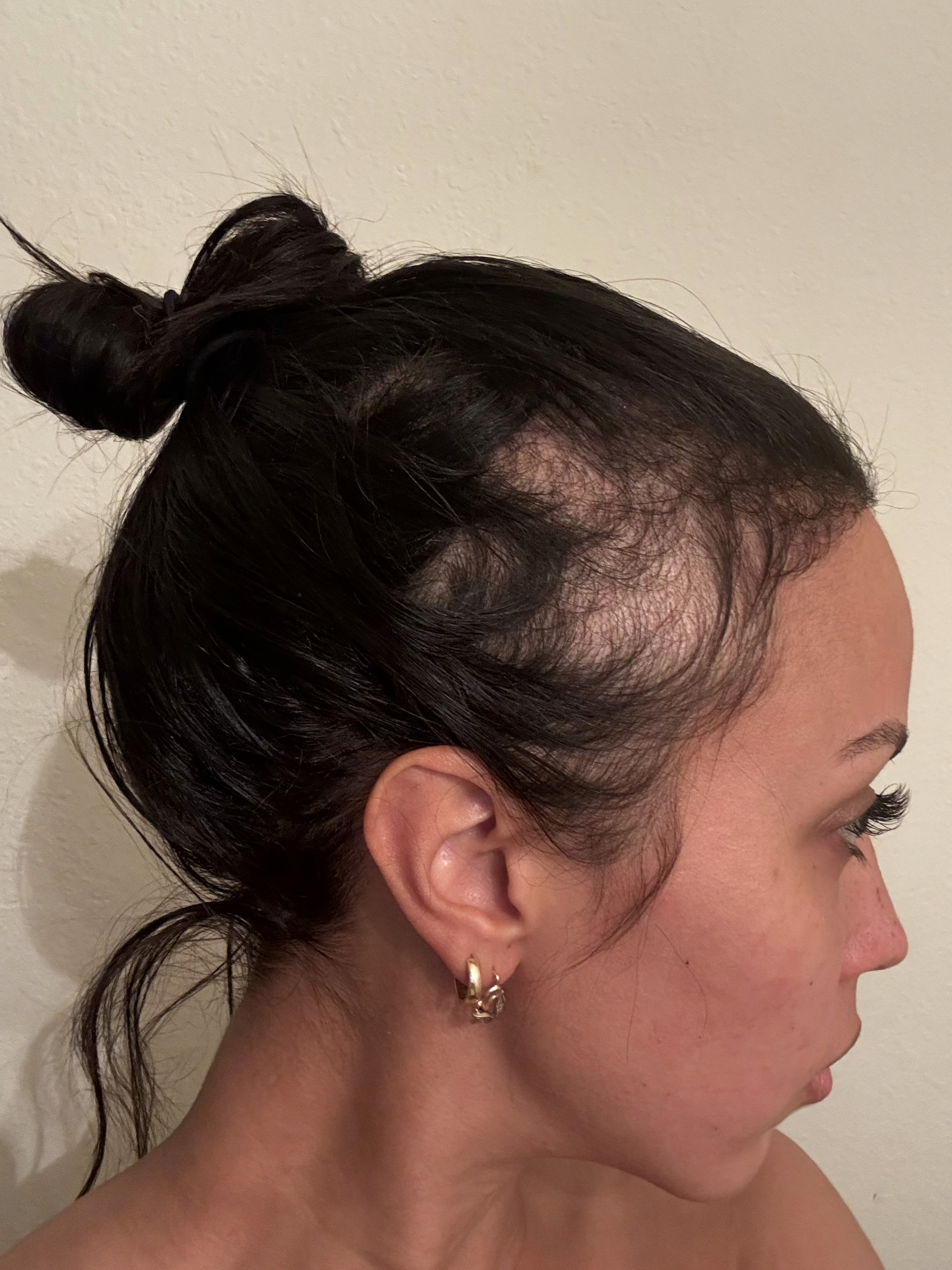 Natural hair growth products for women