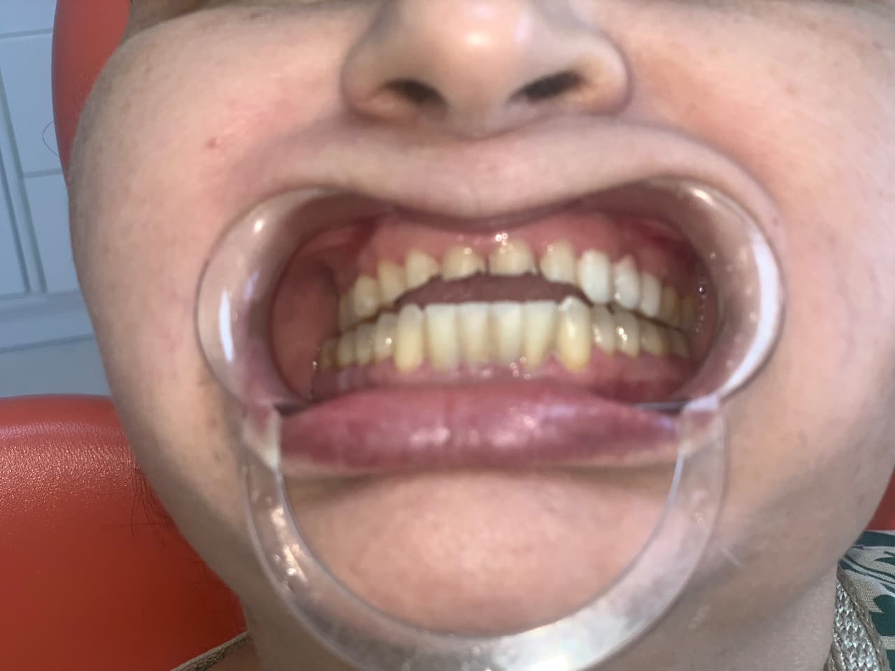 Modern Treatment Technology