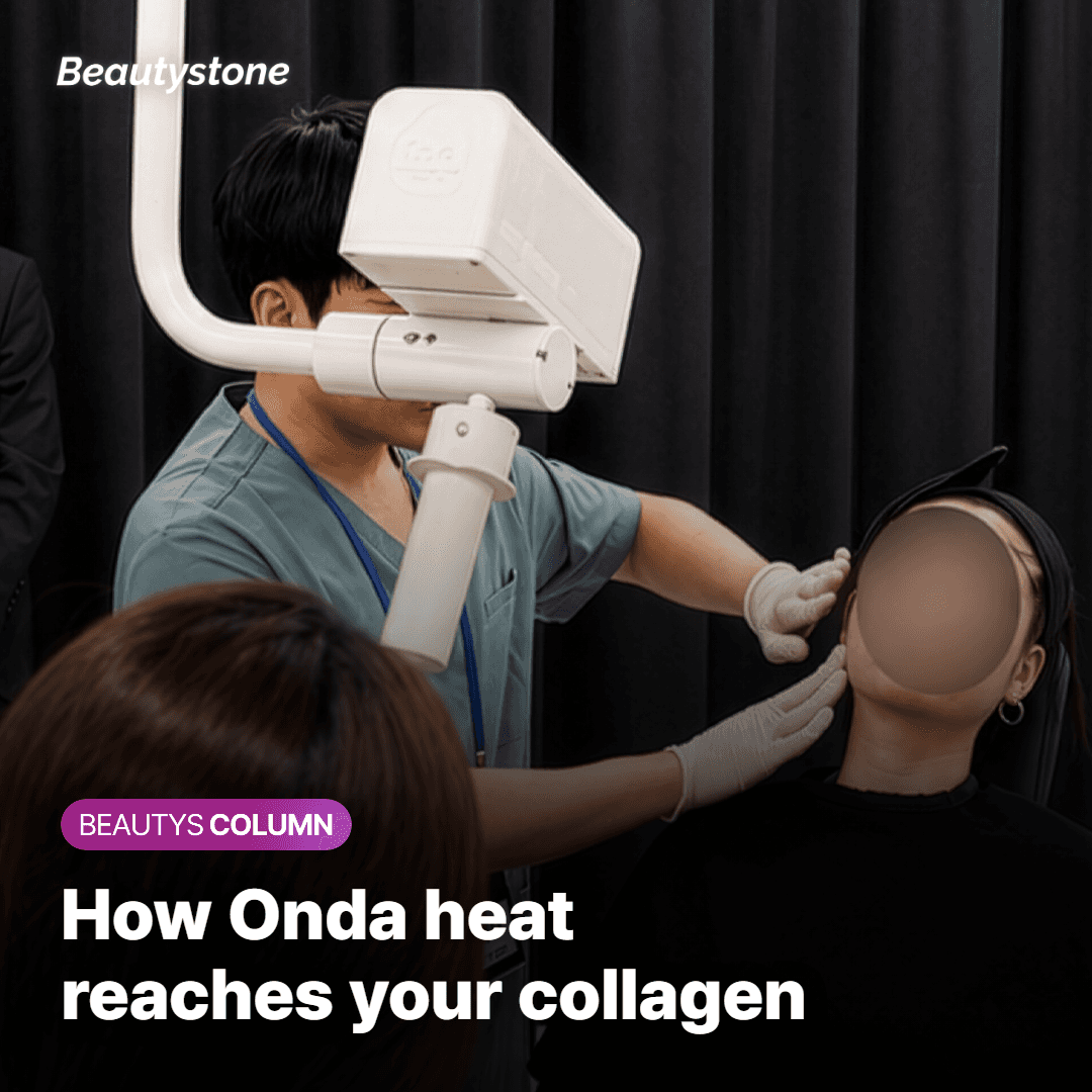 How does Onda actually work?
