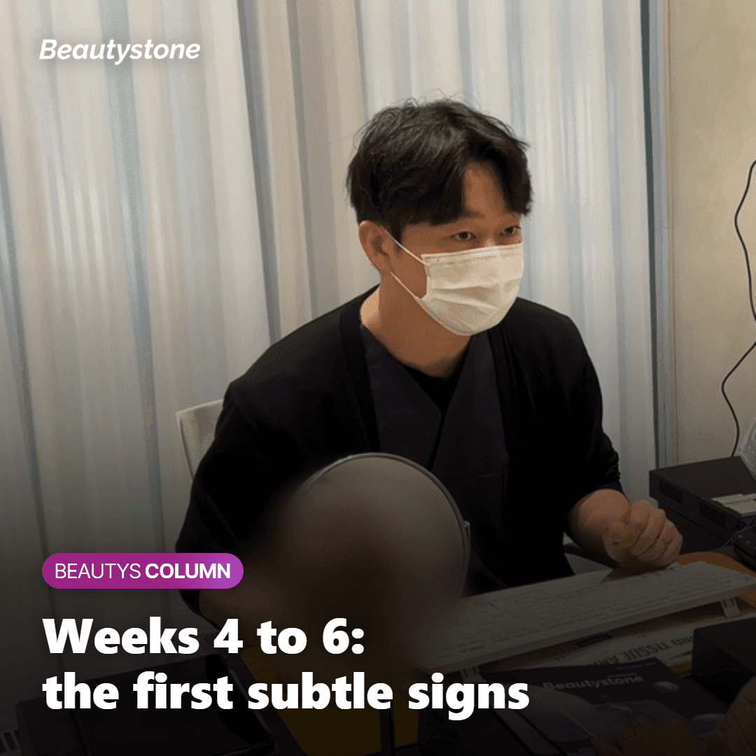 Calendar marking the four to six week window when the first Sculptra signs typically appear