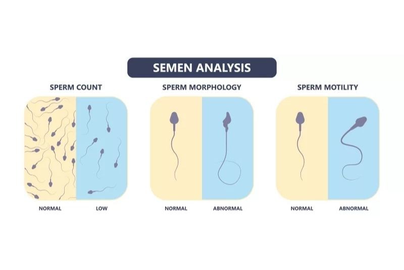 Semen analysis