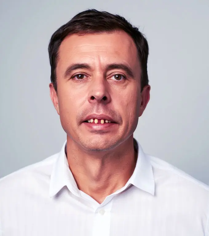 Man in white shirt with gap between front teeth