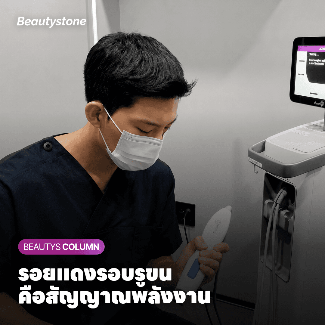 พลังงานแค่ไหนถึงพอ? สัญญาณบนผิวที่คนยิงต้องอ่านให้เป็น