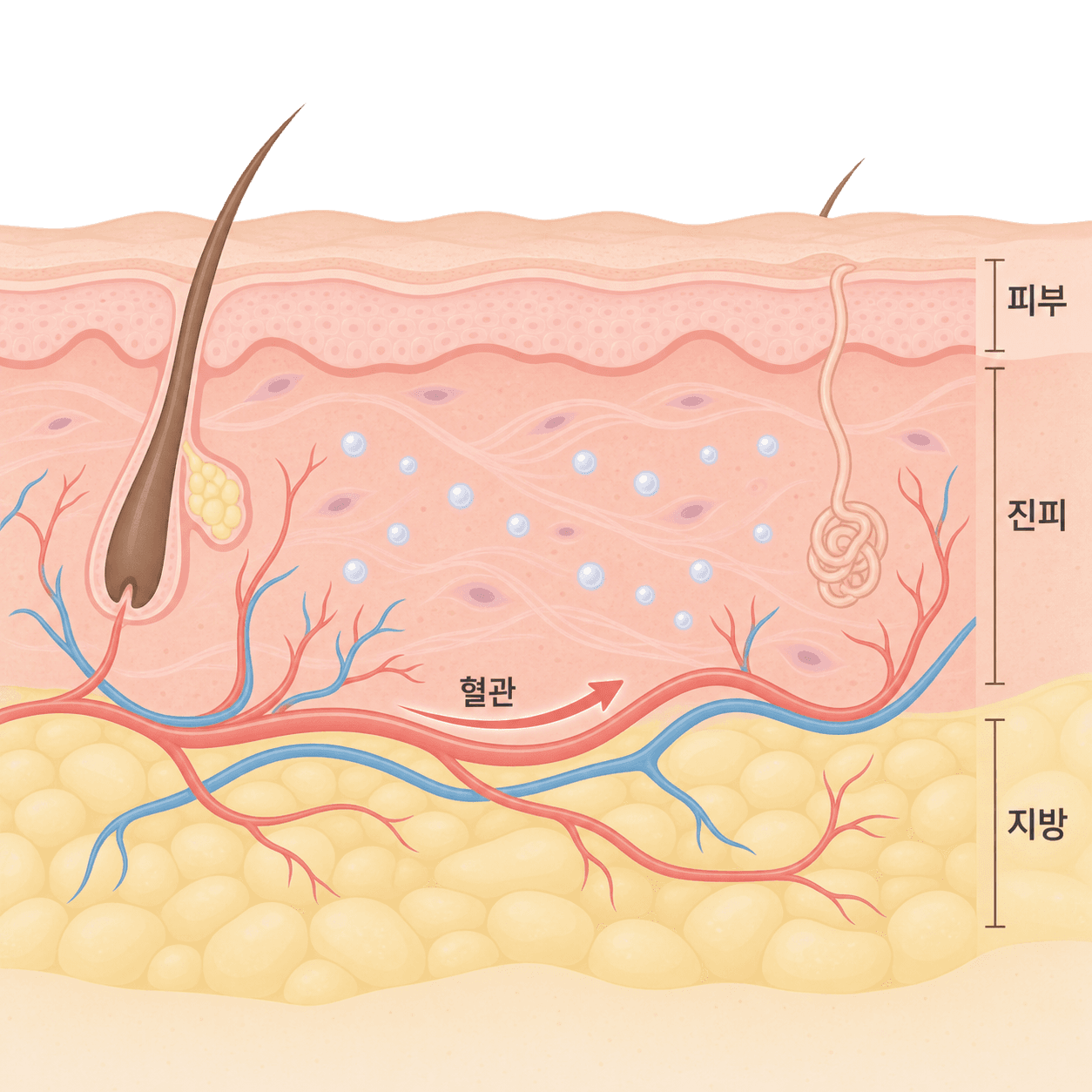 운동하면 얼굴로 가는 피가 늘어서, 아직 예민한 시술 자리는 붓거나 멍이 진해질 수 있어요