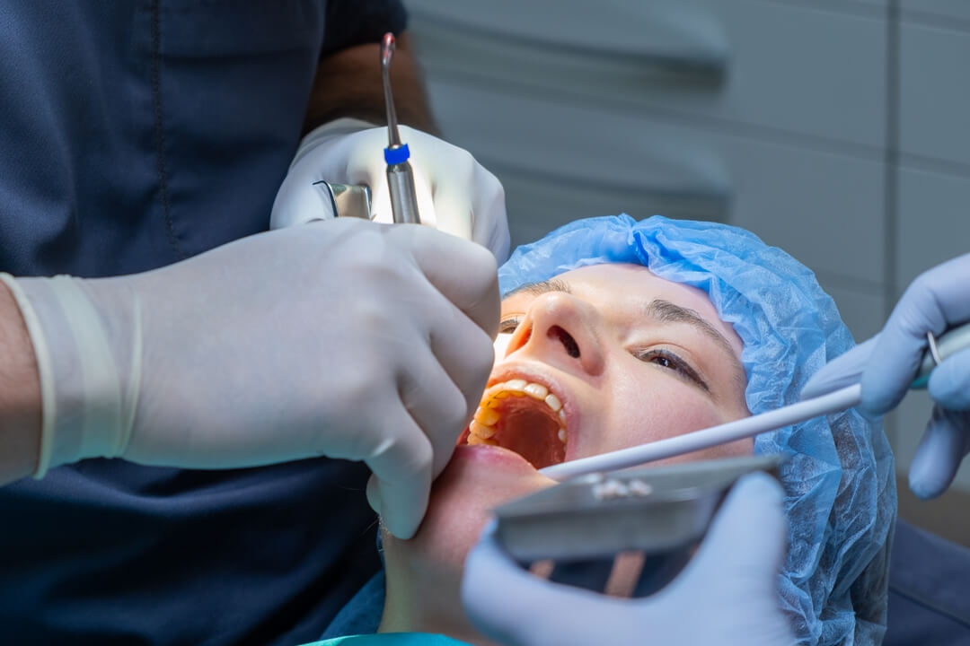 Sobre a especialidade de Cirurgia Oral