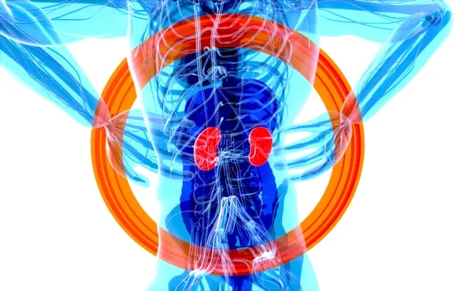 Kidney illustration with a small caution icon, highlighting kidney stone risk with very high calcium intake.