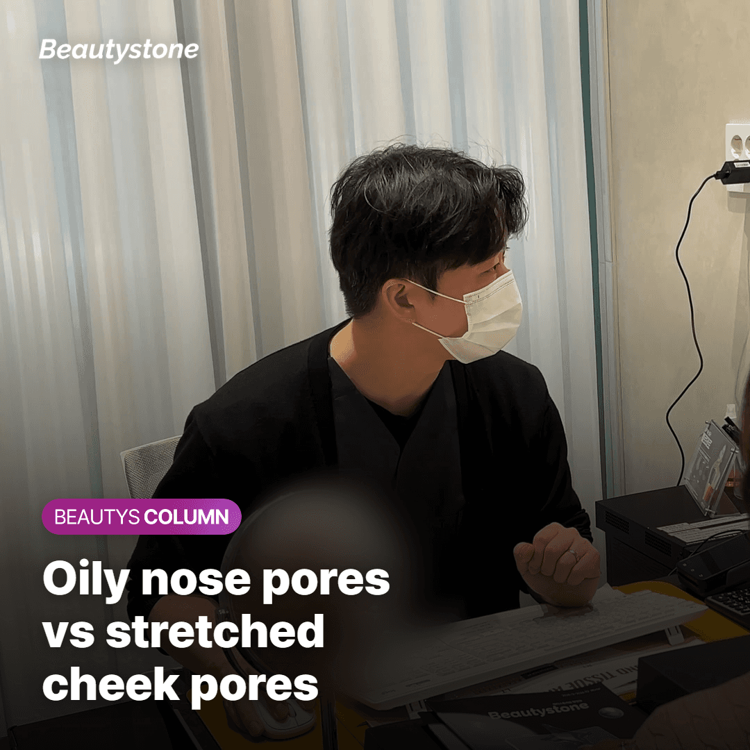 Which Pores Do You Have? Oily Nose Pores vs. Stretched Cheek Pores