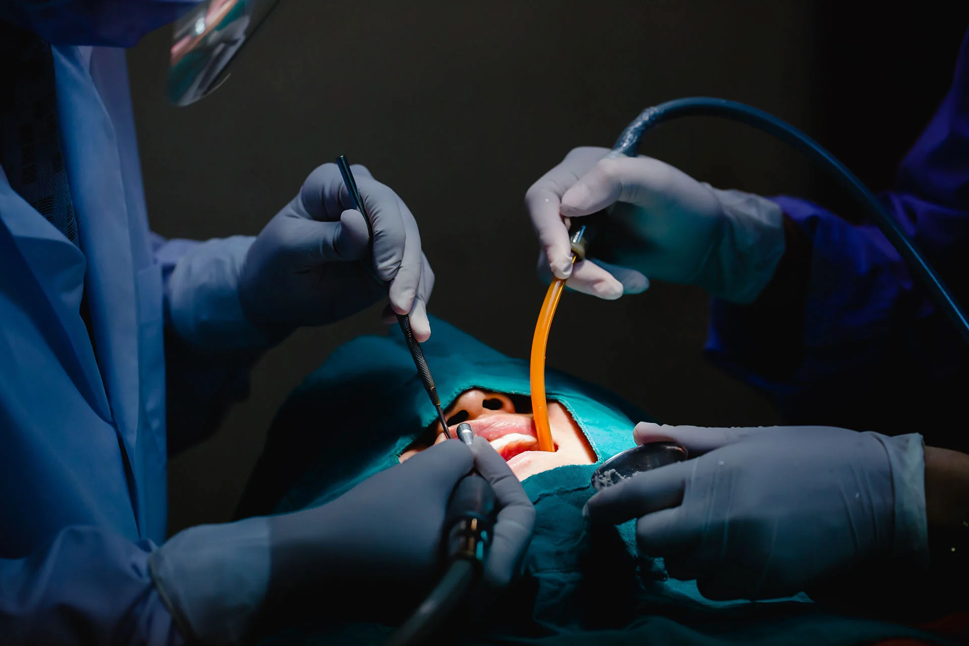 Oral surgery procedure being performed by a surgical team at Valley Oak Oral Surgery in Fresno, CA using advanced instruments and modern surgical techniques in a clinical setting.