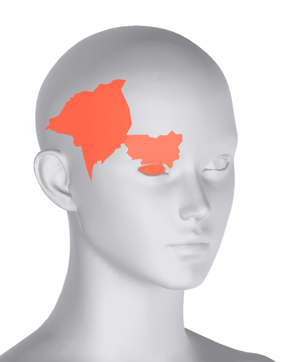 3D head with pain regions