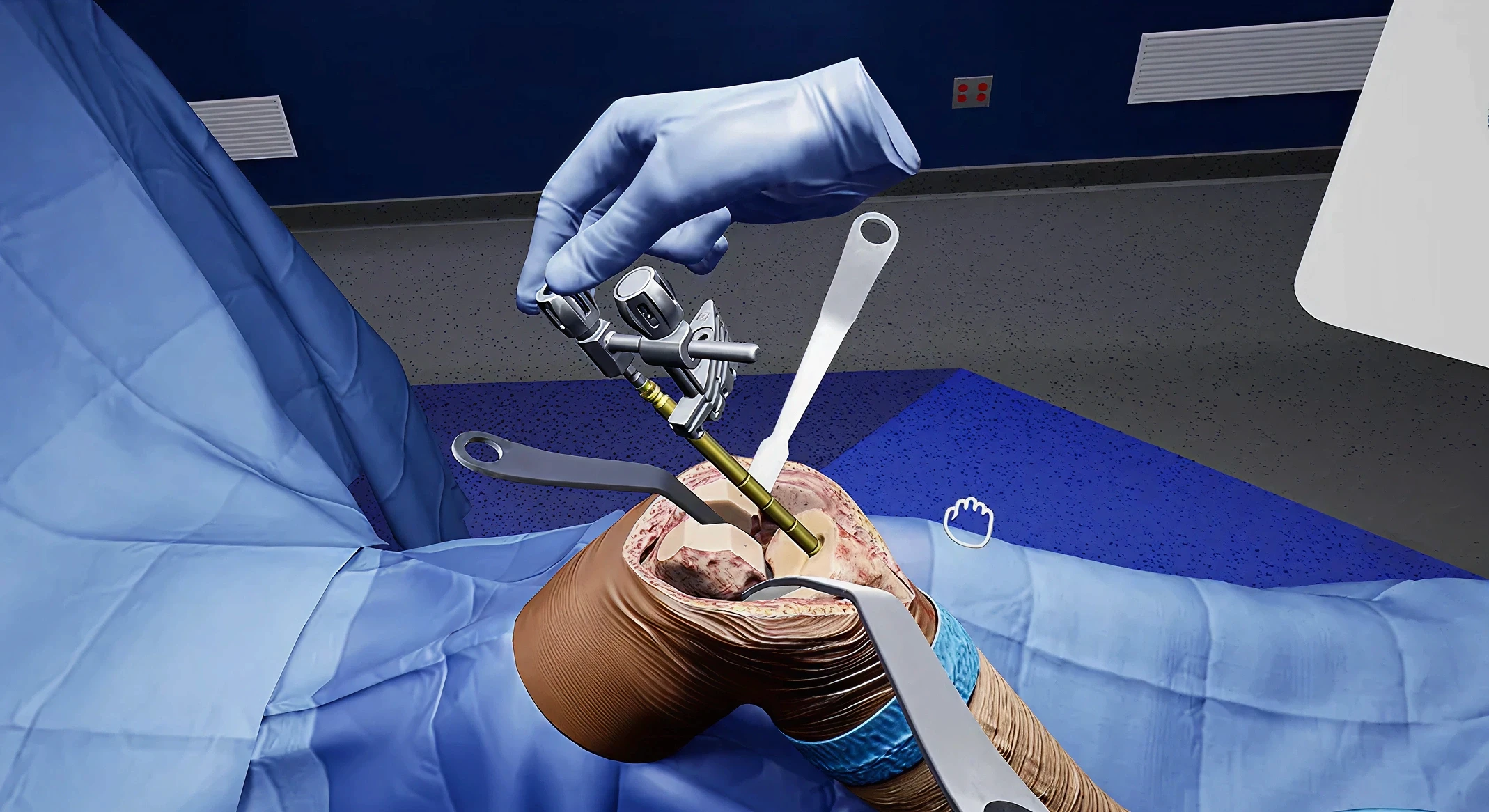 irst-person view inside a VR surgical simulation showing a gloved hand placing an orthopedic implant into a virtual knee joint for medical device training