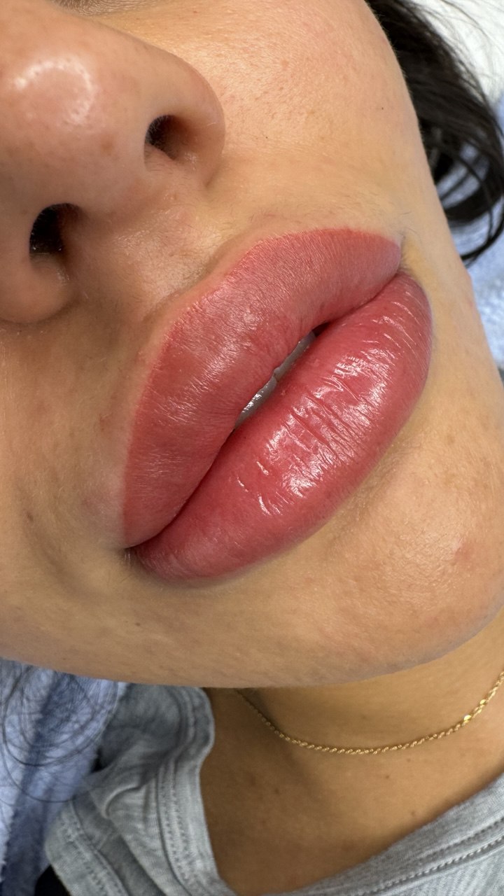 After Lip blush permanent makeup results Boston