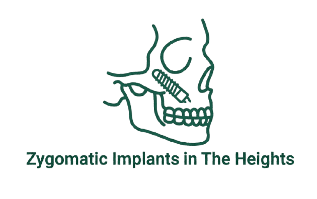 Zygomatic Implants Icon