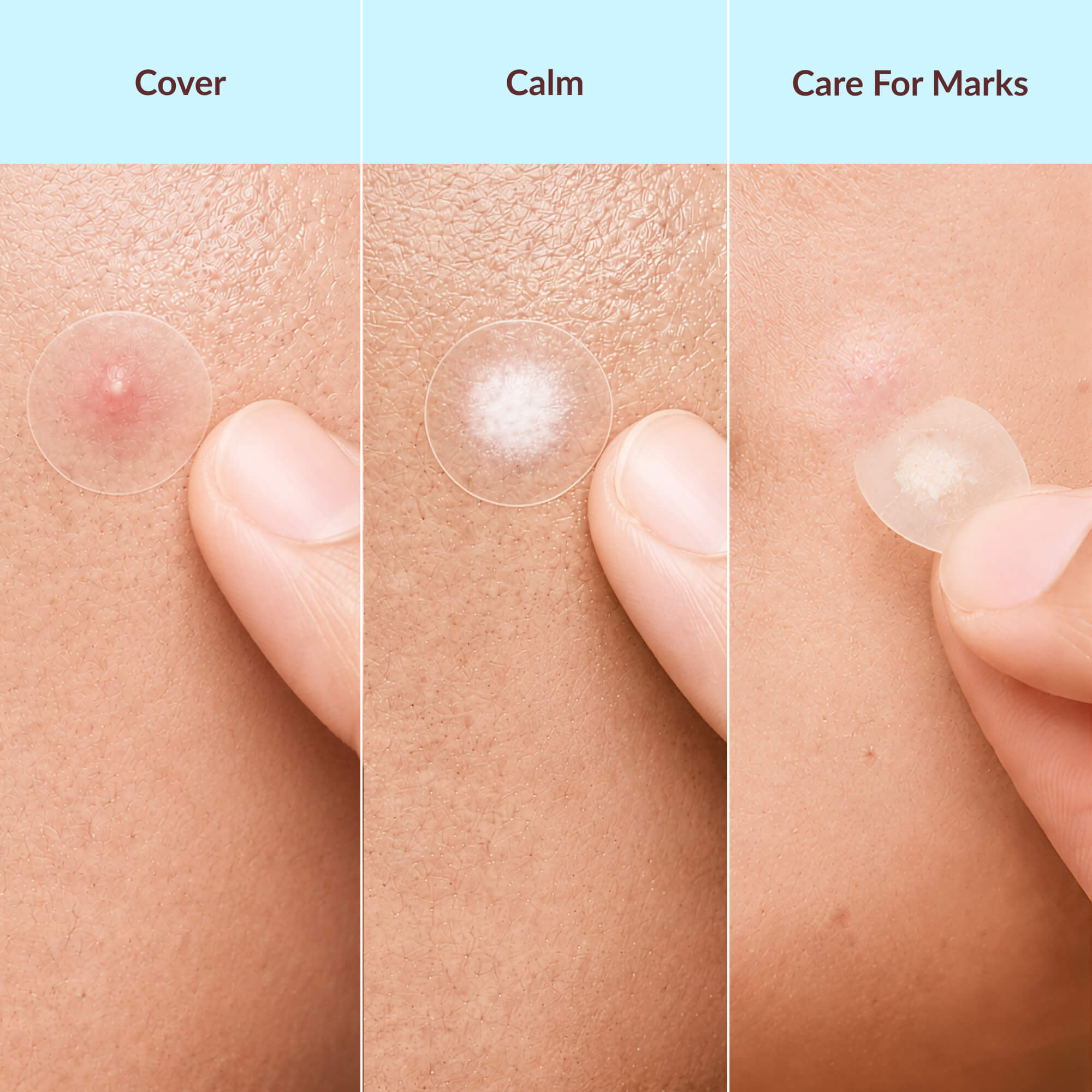 CLERIVY Hydrocolloid Pimple Patch shown during application, wear and gentle removal.