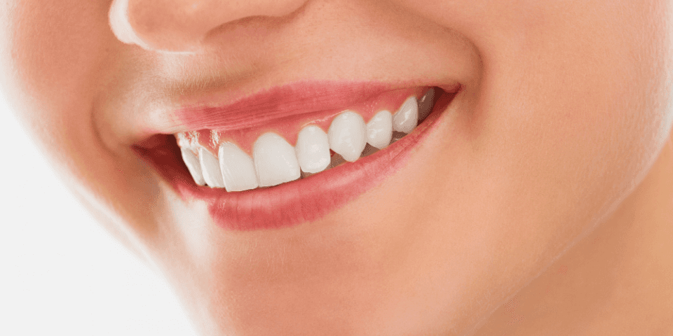 Close-up of a smiling mouth showing white, healthy teeth.