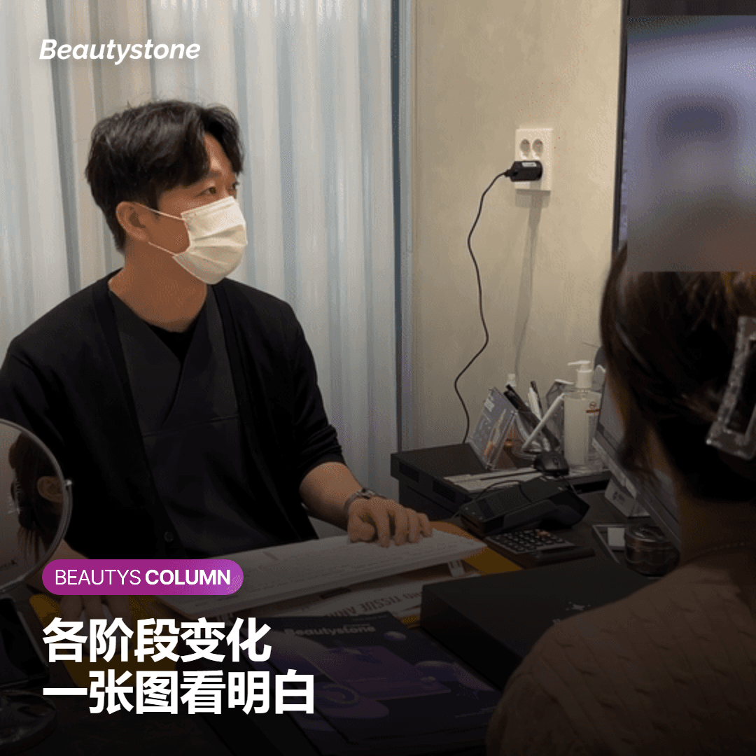 一眼看清不同时间点的轮廓变化