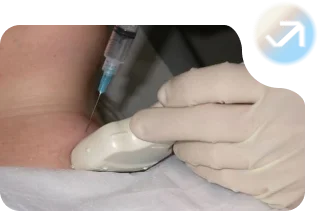 Biopsy (if needed) treatment step image