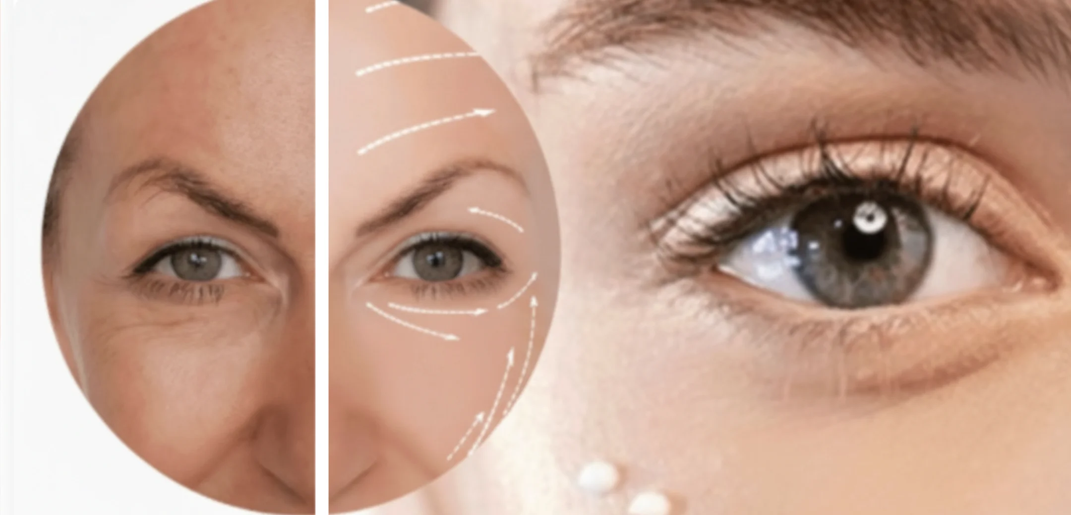 Neuropeeling odmładzający na zmarszczki pokazane efekty zabiegu w gabinecie Belleza w Rzeszowie