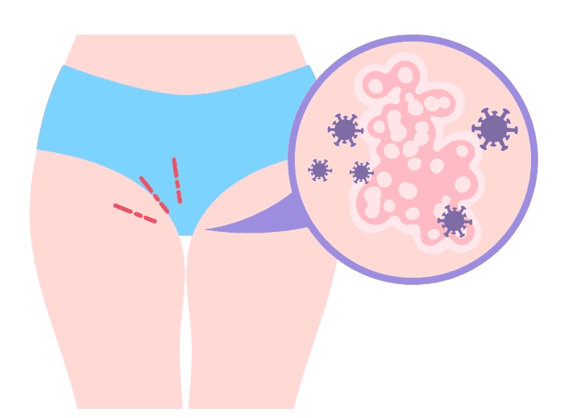 analyses dans un prélèvement vaginal