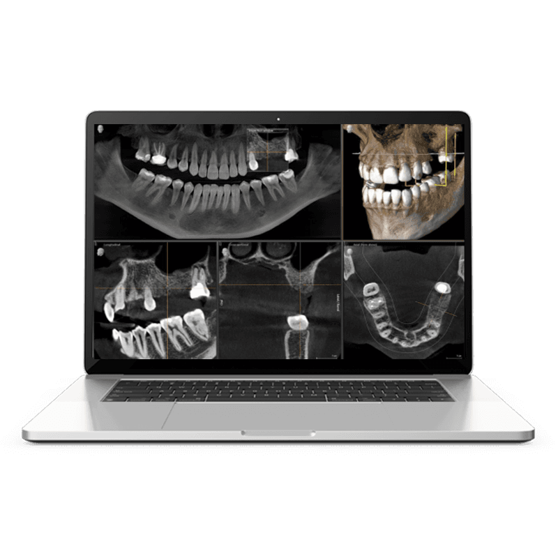 Digital Treatment Planning