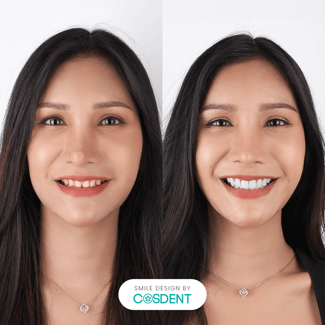 หน้าคม ยิ้มกว้าง 20 ซี่