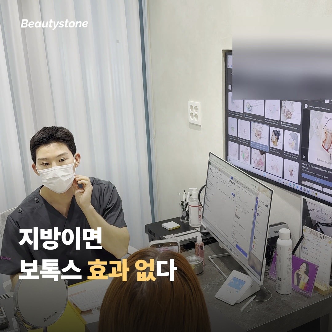 귀밑샘 보톡스 — 침샘이 커서 얼굴이 둥글어 보일 때