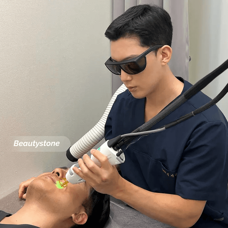 수염자국 레이저 종류 비교 GentleMax Pro Plus 시술 이미지