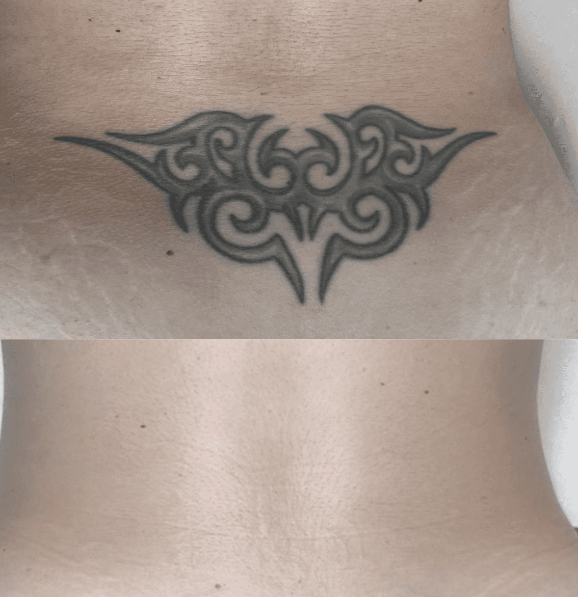 Scalp Micropigmentation Schweiz