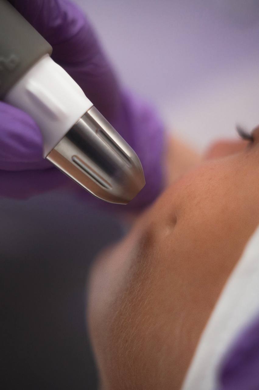 Dermadrop TDA для глубокого увлажнения кожи в Body Expert Tallinn.