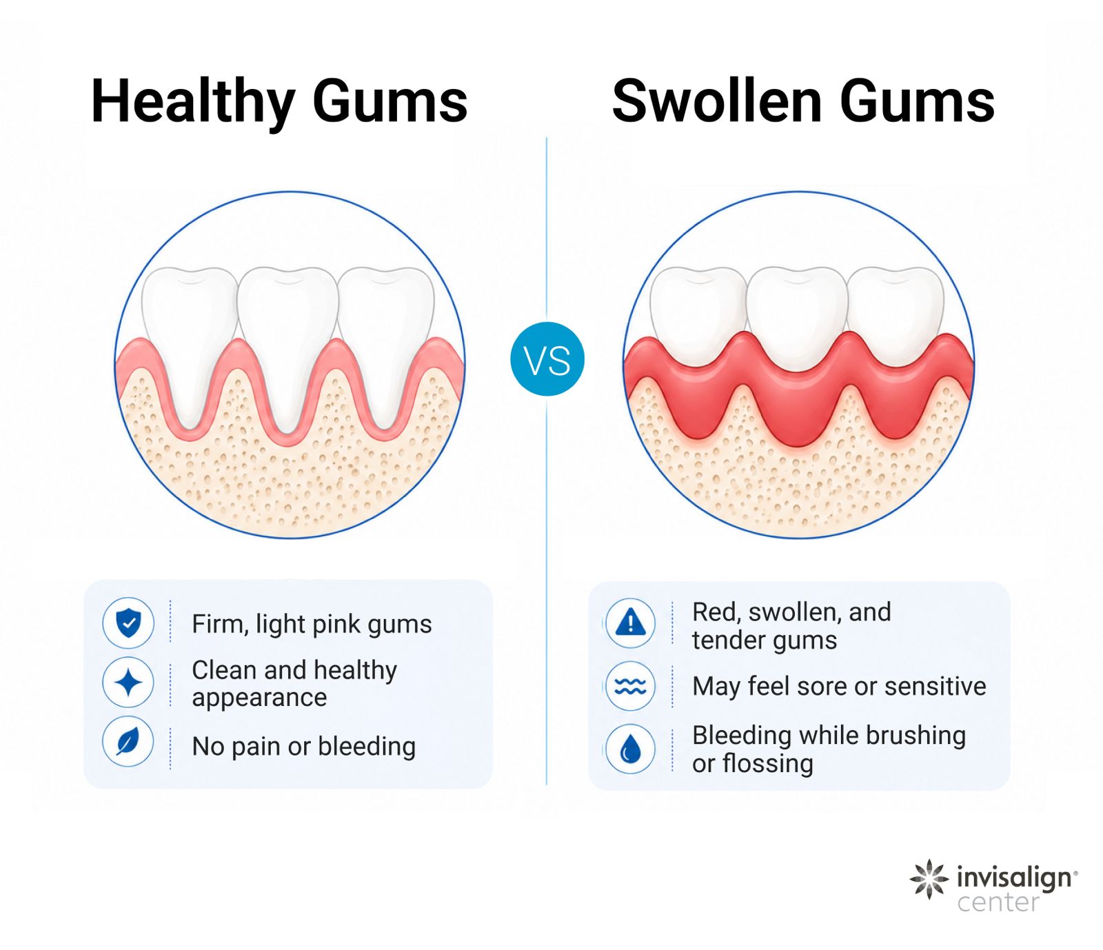 How healthy gums compare to swollen gums