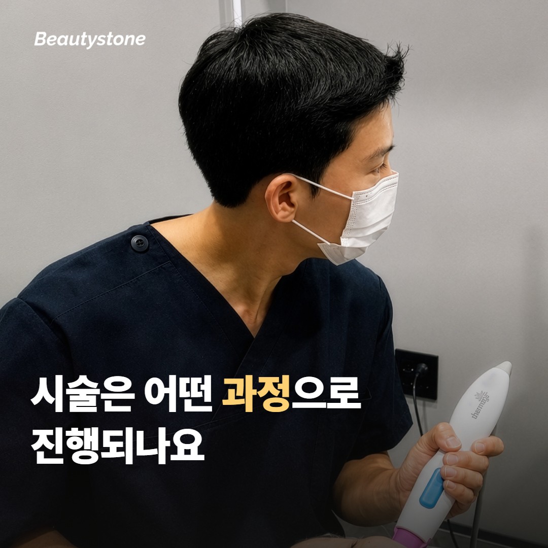 시술은 어떤 과정으로 진행되나요