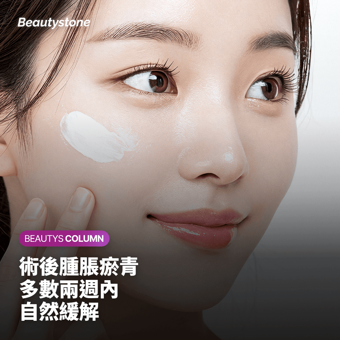 當線雕不是最好的答案時，有哪些替代選項