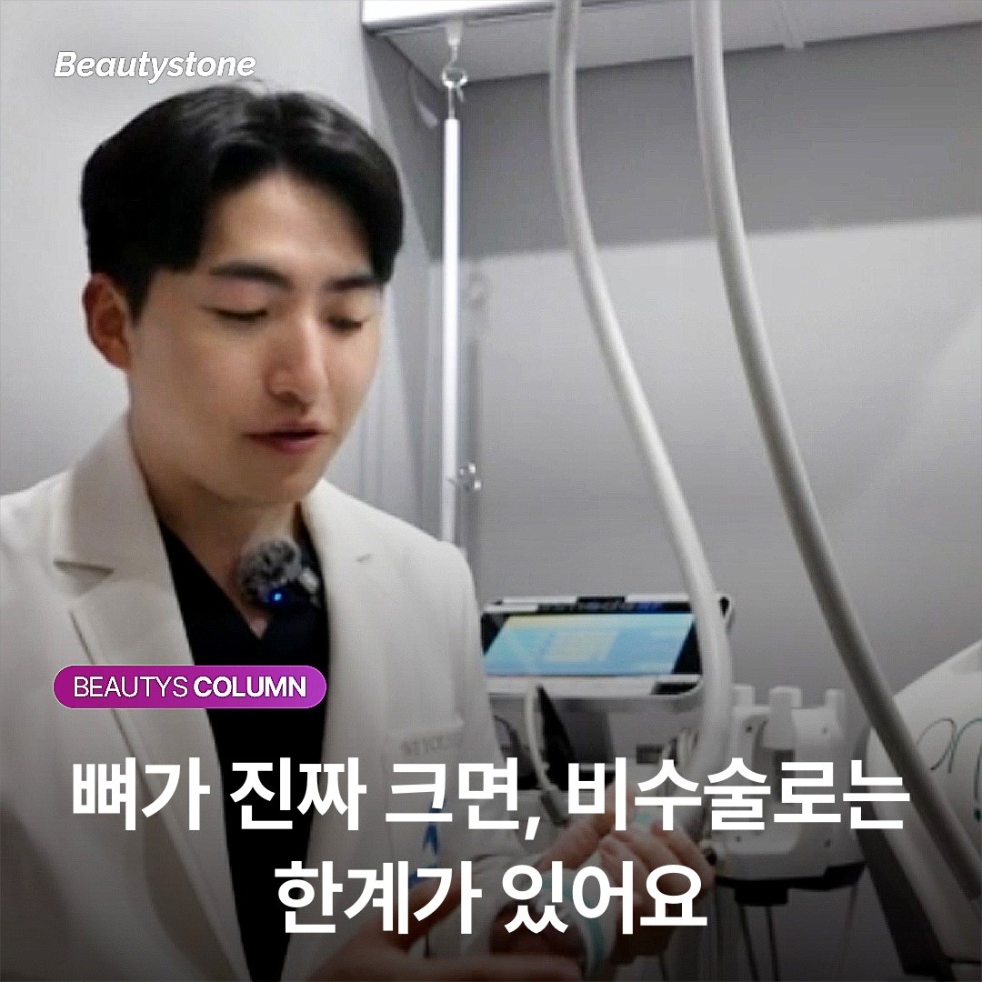 뼈가 진짜 크면, 비수술로는 한계가 있어요