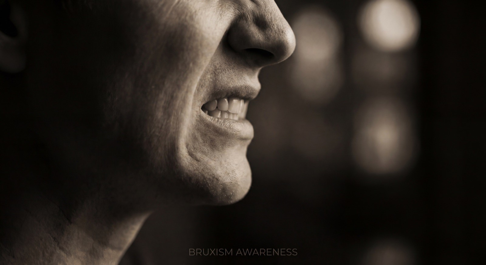 Bruxism Treatment Marbella - INIMA Dental Clinic