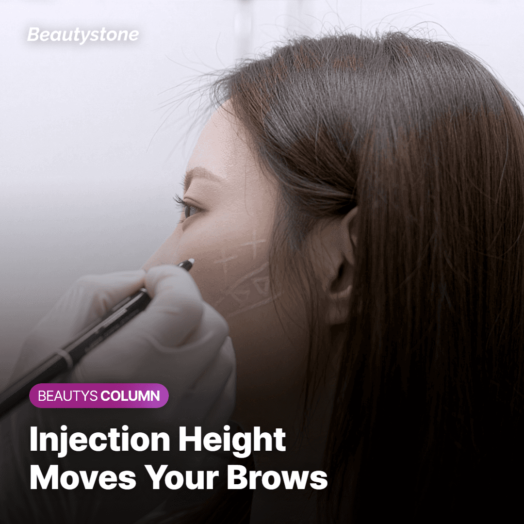 Doctor watching a patient raise her brows and frown before marking forehead injection points