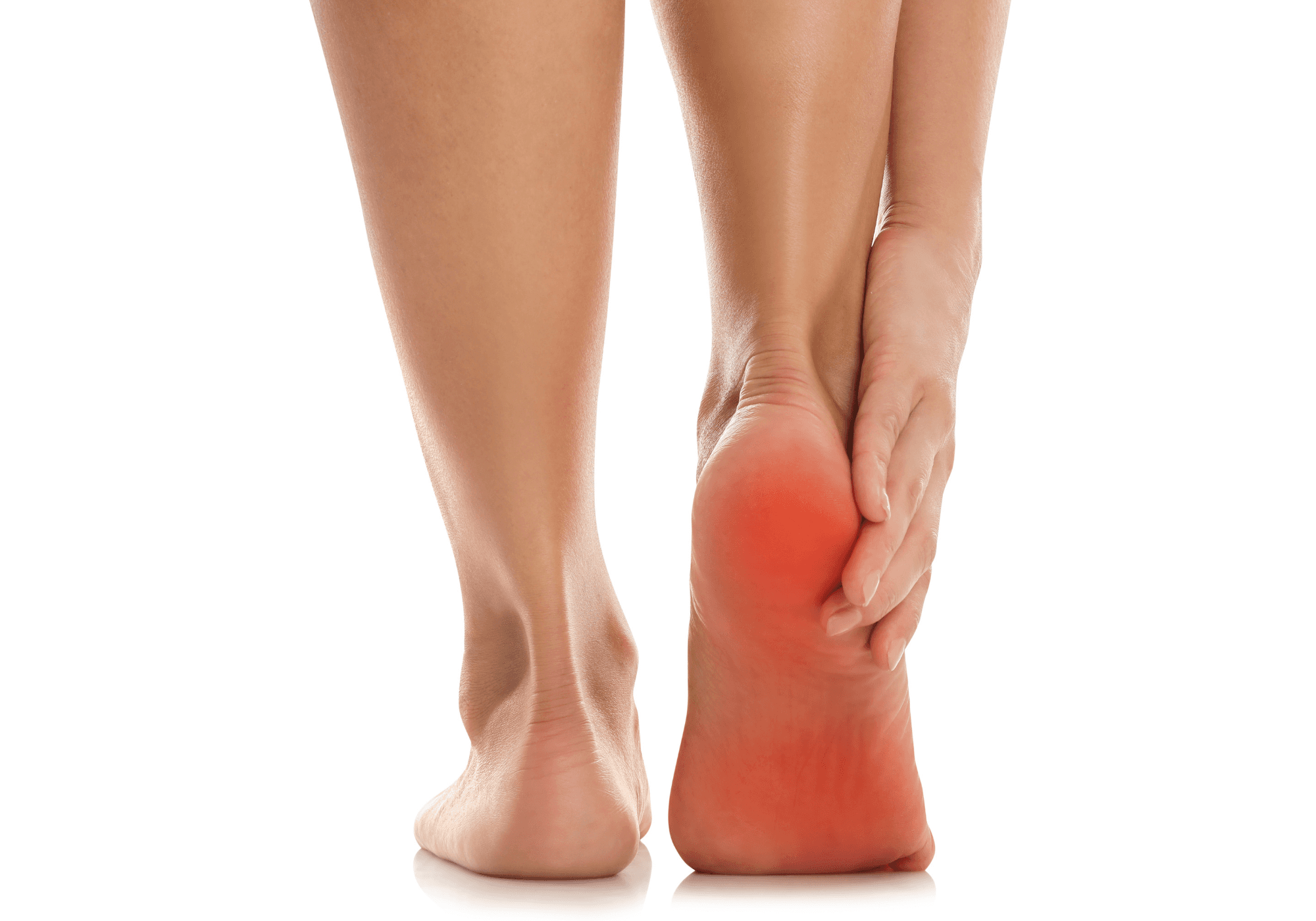 Plantar fasciitis