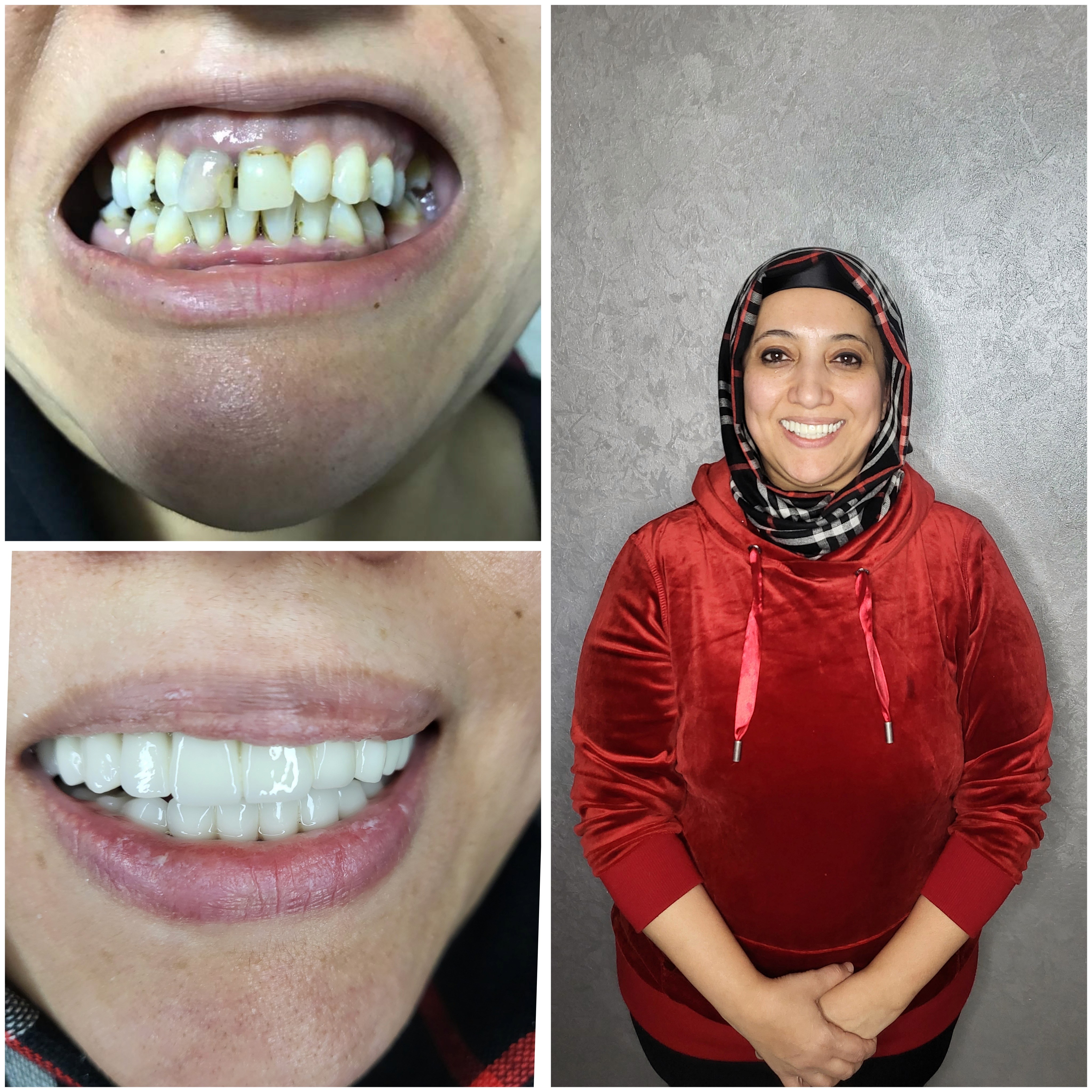 Beautiful woman holding a skin care product