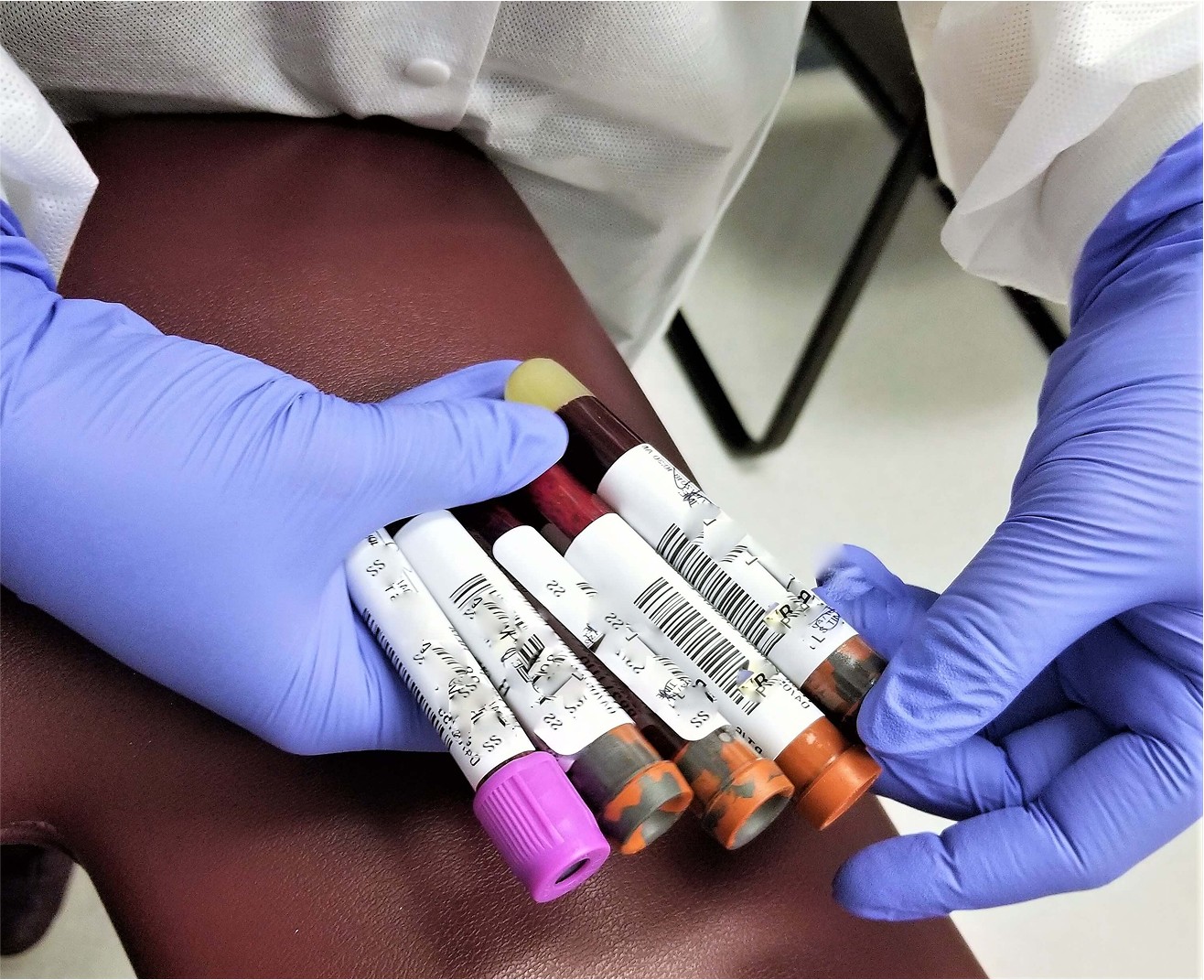CBC blood tests