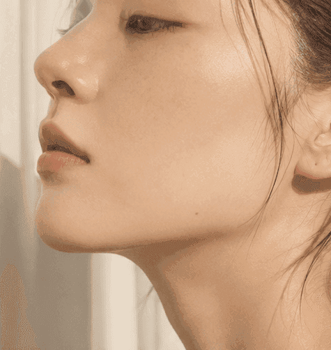 리프팅 시술 안내