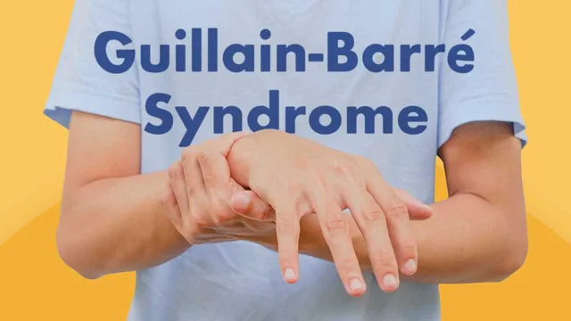 Guillain-Barre Syndrome, Public Health Crisis, Neurological Disorders, Water Safety