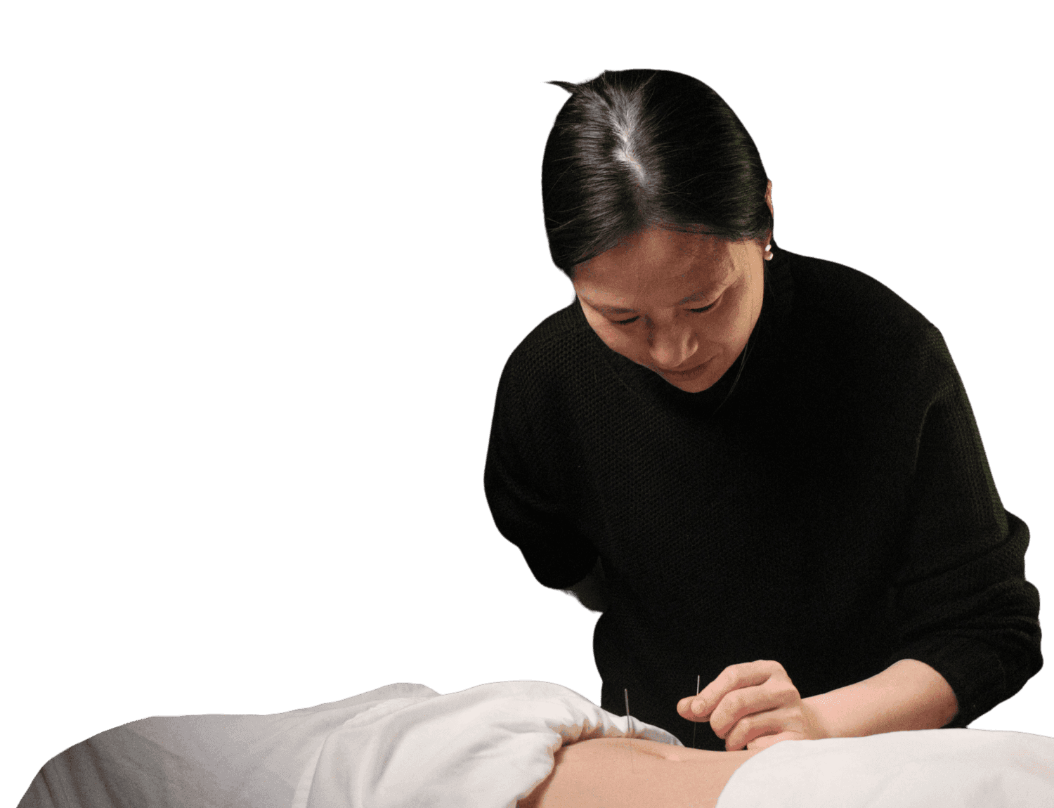 Acupuncture treatment performed on a patient's stomach by an acupuncturist